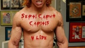 What Causes Red Hair