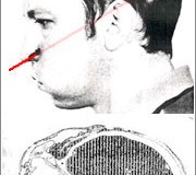 What Happens When You Stick Your Head Into a Particle Accelerator