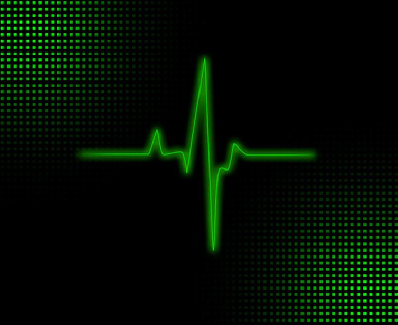 How To Read Cardiogram Chart