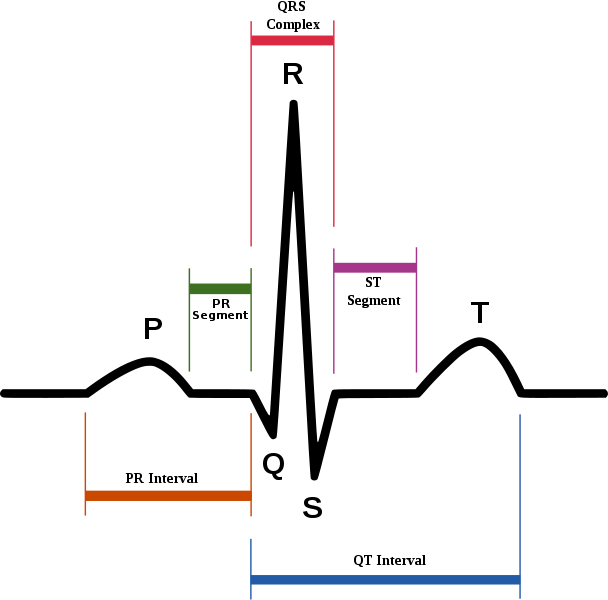 Ekg Chart