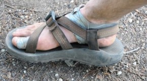 What Causes Blisters