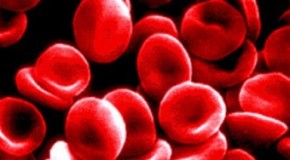 De-oxygenated Blood Turns Dark Red, Not Blue
