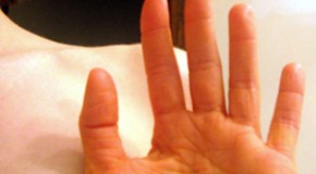 If You Eat an Excessive Amount of Carrots, Your Skin Will Turn an Orangish/Yellow Shade