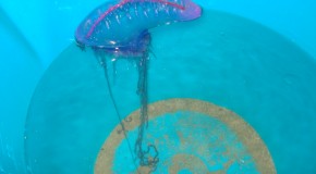 How to Treat a Jellyfish Sting