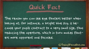 Why You Can See Eye Floaters Better When Looking at the Sky