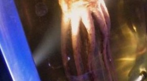 The Colossal Squid Has a Doughnut Shaped Brain With Their Esophagus Running Through the Hole