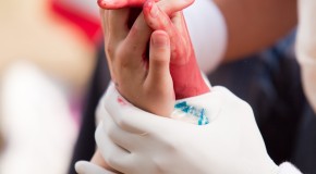 Top 5 First Aid Tricks Everyone Should Know, Part 1: Direct Pressure