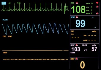 ECG