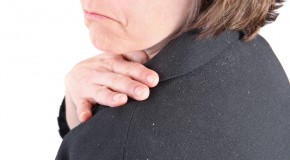 What Causes Dandruff