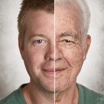 aging