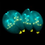 Toxoplasma_gondii-340x340