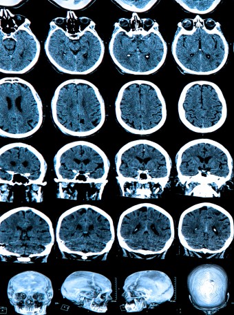 brain-scan