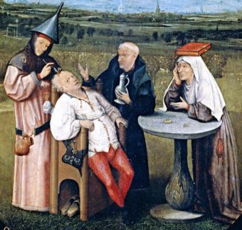 trepanning