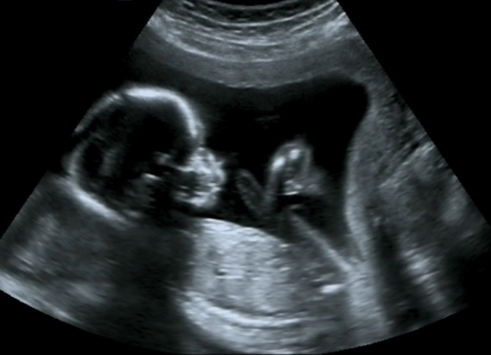 DIAGRAM] Diagram Of A Fetus FULL Version HD Quality A Fetus -  MERIDIANDIAGRAM.AMFO.IT