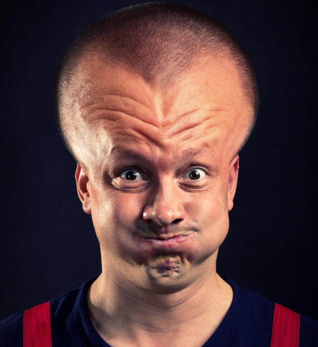 Exploding Hoofd Exploding Head Syndrome