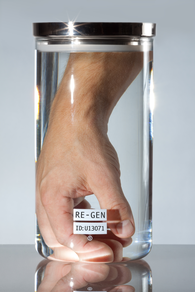 Will Hospitals Give Back an Amputated Limb if You Ask For It?